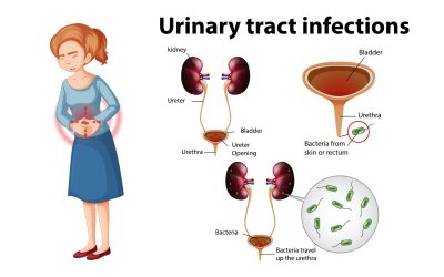 Why women more are prone to UTIs