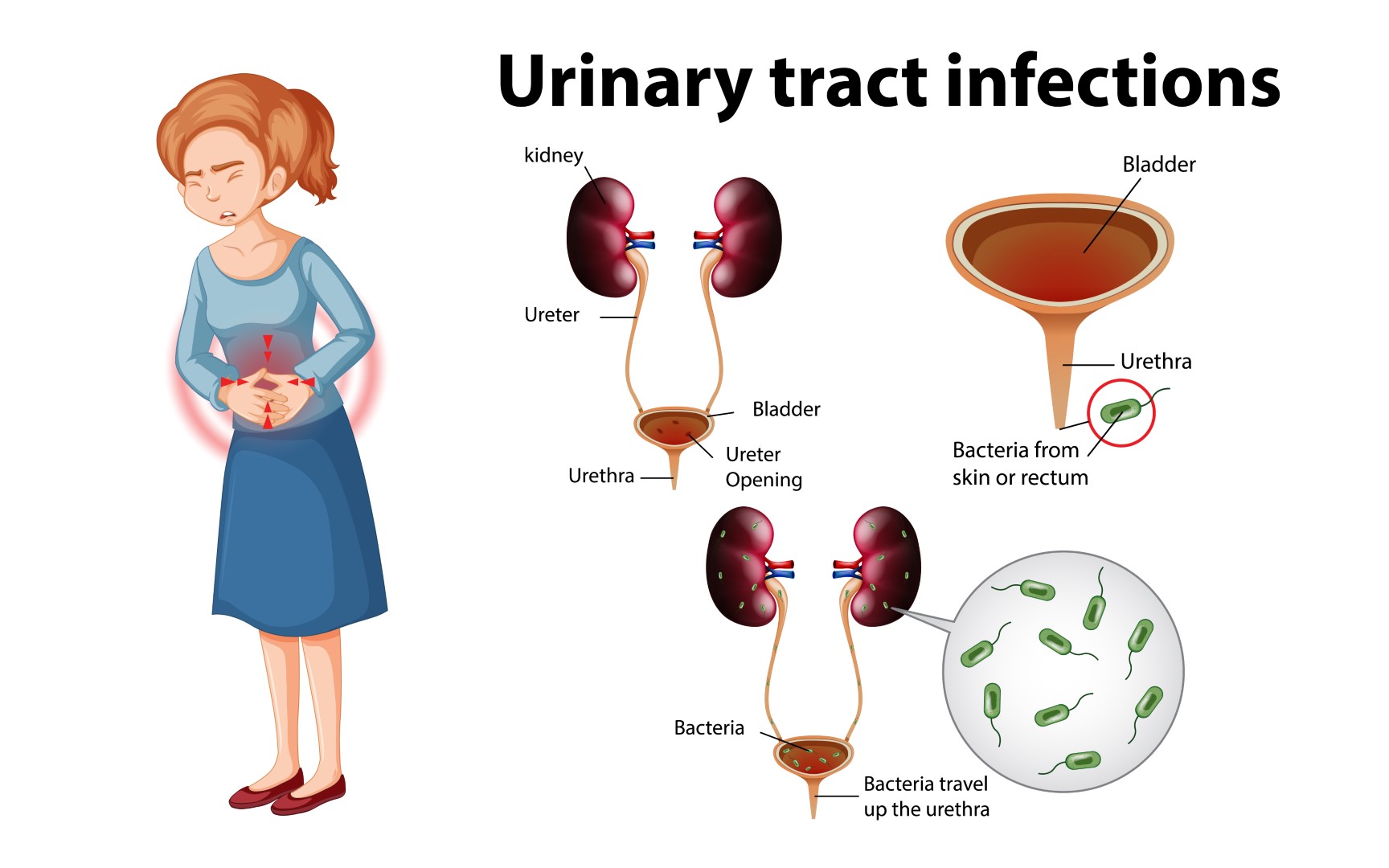 why-women-more-are-prone-to-utis-syner-med-pharmaceuticals-i-your